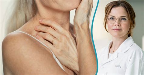 råd till huden istanbul